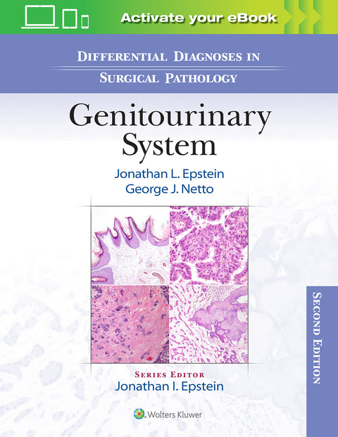 Differential Diagnoses In Surgical Pathology Genitourinary System 2e