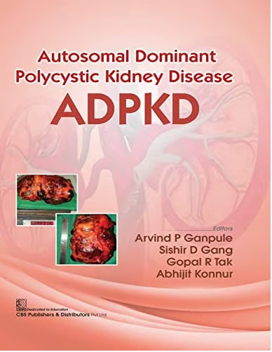Autosomal Dominant Polycystic Kidney Disease Adpkd (Flexibond 2022)