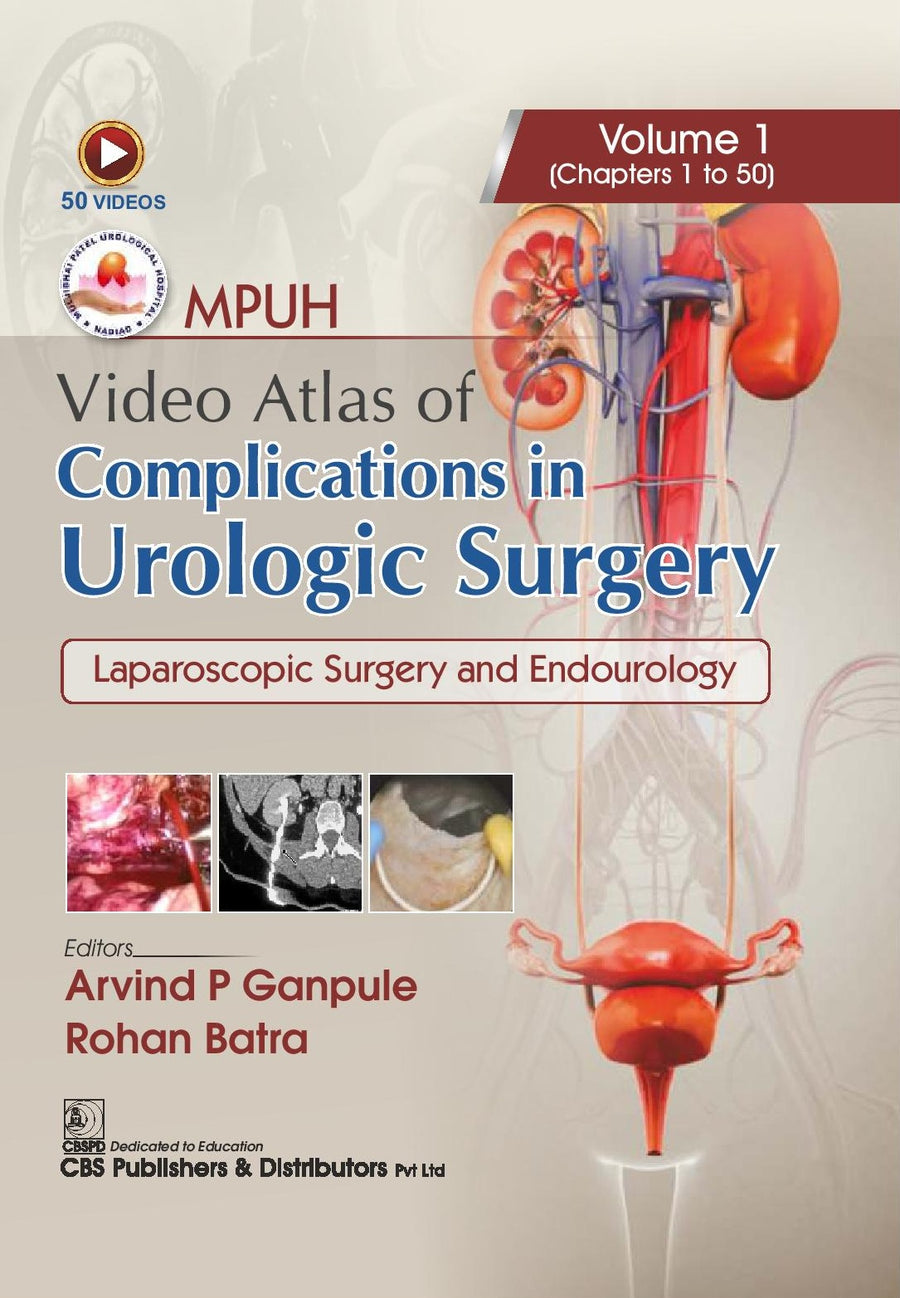 Mpuh Video Atlas Of Complications In Urologic Surgery Laparoscopic Surgery And Endourology Vol 1 Chapters 1 To 50 (HB)