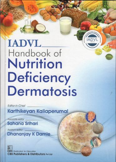 IADVL Handbook Of Nutrition Deficiency Dermatosis (HB)