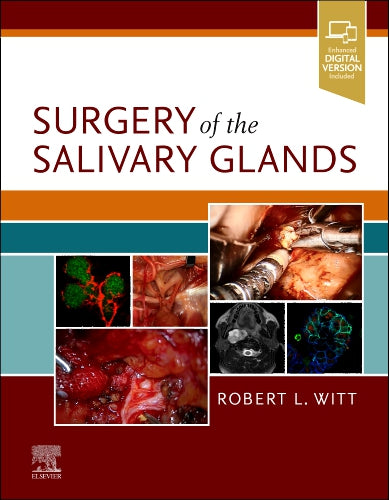 Surgery of the Salivary Glands (HB)