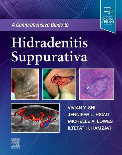 A Comprehensive Guide To Hidradenitis Suppurativa With Access Code (HB)