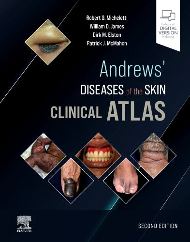Andrews Diseases Of The Skin Clinical Atlas With Access Code 2e (HB)