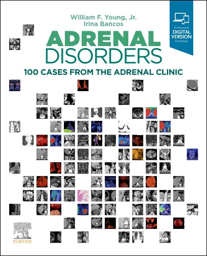 Adrenal Disorders 100 Cases From The Adrenal Clinic With Access Code (HB)