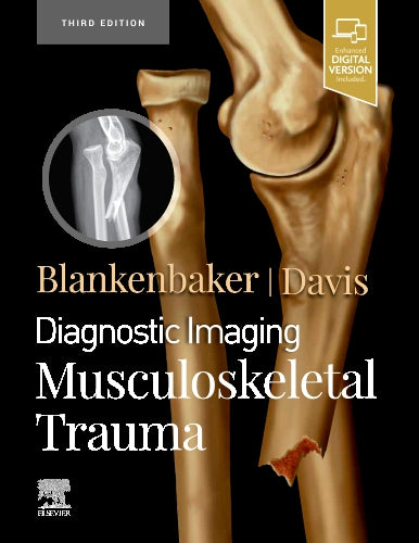 Diagnostic Imaging: Musculoskeletal Trauma,3e
