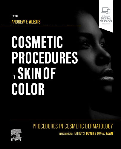 Procedures In Cosmetic Dermatology: Cosmetic Procedures In Skin Of Color (HB)