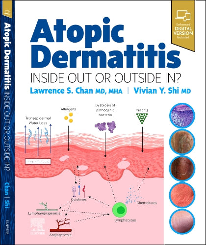 Atopic Dermatitis Inside Out Or Outside In? With Access Code (HB)