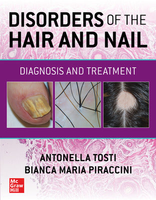 DISORDERS OF THE HAIR AND NAIL DIAGNOSIS AND TREATMENT (HB)