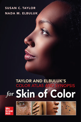 Taylor And Elbuluks Color Atlas And Synopsis For Skin Of Color (PB)