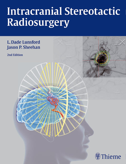Intracranial Stereotactic Radiosurgery, 2E