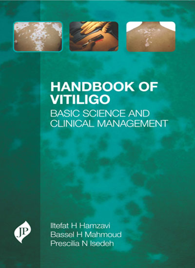 Handbook of Vitiligo
