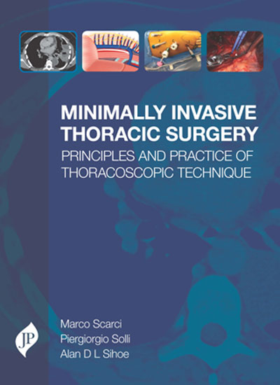 Minimally Invasive Thoracic Surgery Principles and Practice of Thoracoscopic Technique