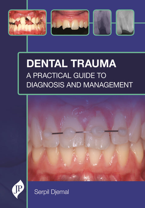 Dental Trauma: a Practical Guide to Diagnosis and Management