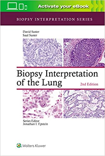 Biopsy Interpretation of the Lung, 2nd Edition 2020
