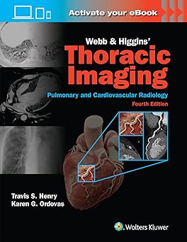Webb and Higgins' Thoracic Imaging, 4th Edition 2025