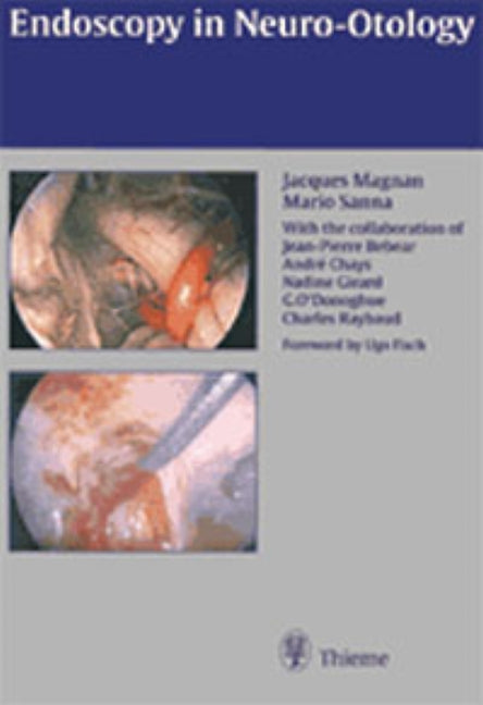 Endoscopy in Neuro-Otology