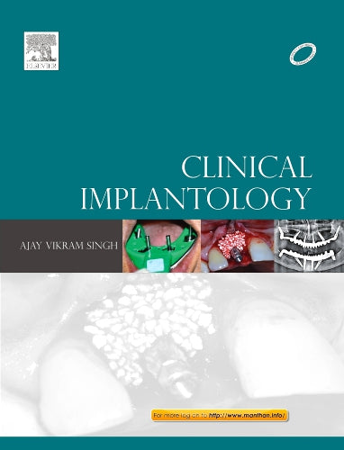 Clinical Implantology; E-Book also available,1e