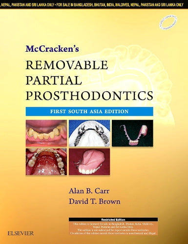 Mc Cracken's Removable Partial Prosthodontics,1st South Asia Edition