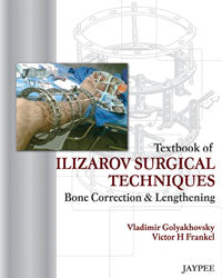 Textbook of Ilizarov Surgical Techniques Bone Correction&Lengthening