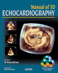 Manual of 3D Echocardiography 1/E 2013