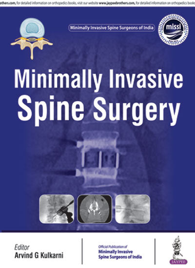 Minimally Invasive Spine Surgery(Official Publication of Minimally Invasive Spine Surgeons of India)