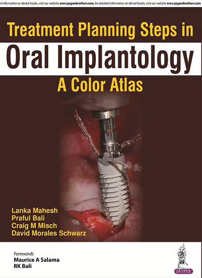 Treatment Planning Steps in Oral Implantology:A Color Atlas