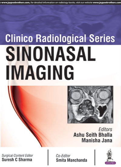 Clinico Radiological Series:Sinonasal Imaging