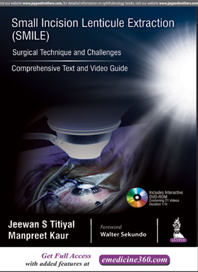 Small Incision Lenticule Extraction (Smile) Surgical Technique and Challenges:Comprehensive Text