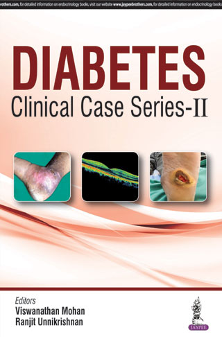DIABETES CLINICAL CASE SERIES-II 1/E 2018