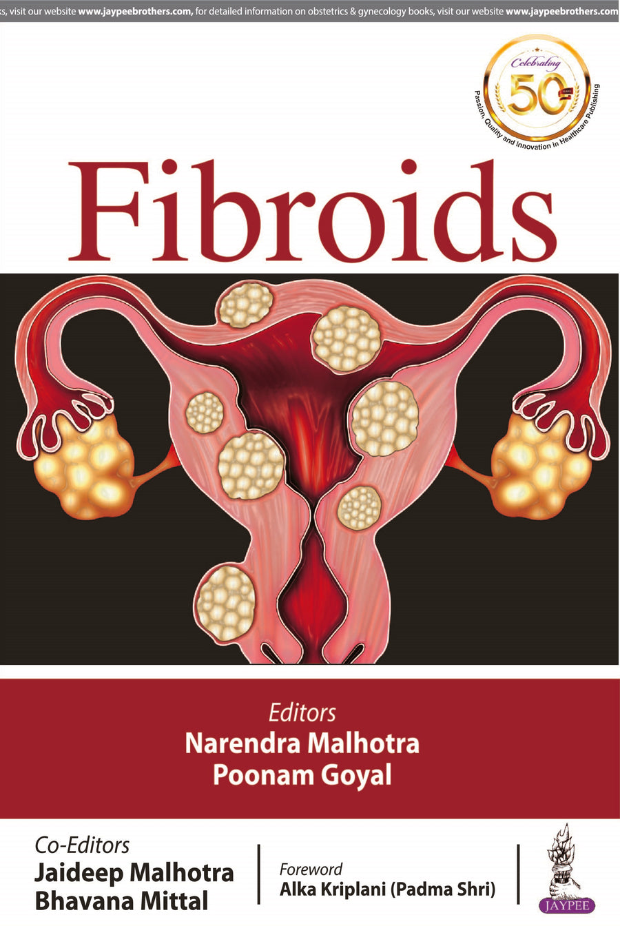 Fibroids