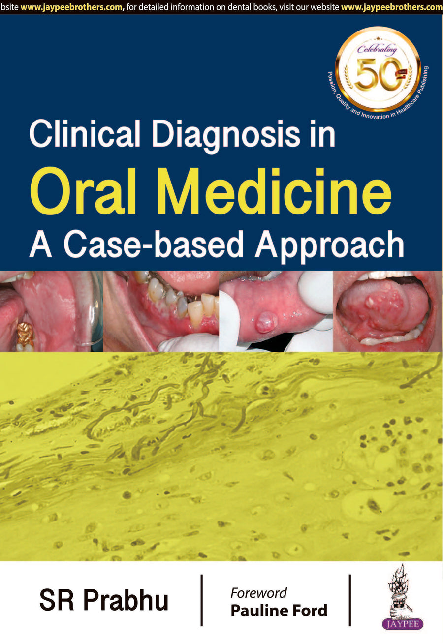 Clinical Diagnosis in Oral Medicine: a Case-Based Approach