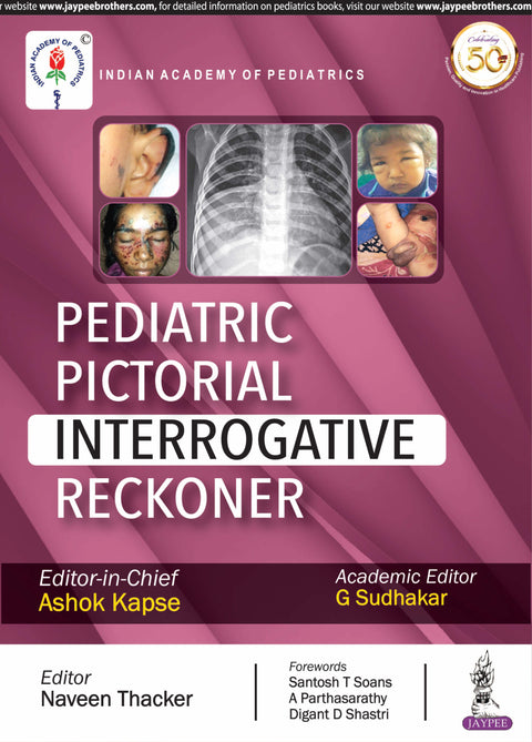 Pediatric Pictorial Interrogative Reckoner