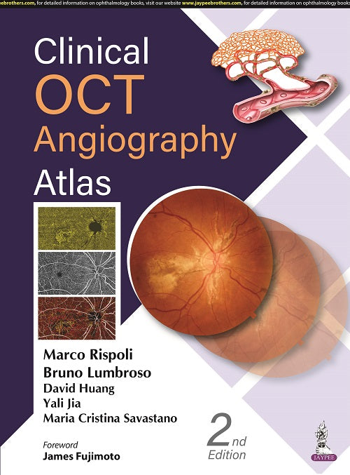 Clinical Oct Angiography Atlas