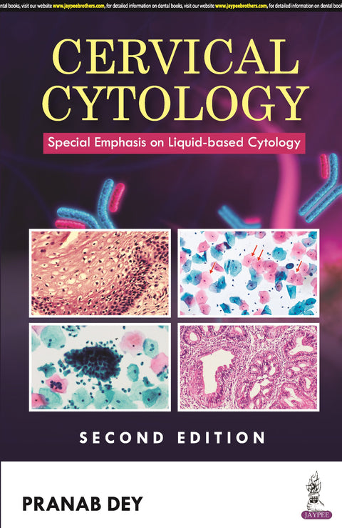 Cervical Cytology: Special Emphasis on Liquid-Based Cytology