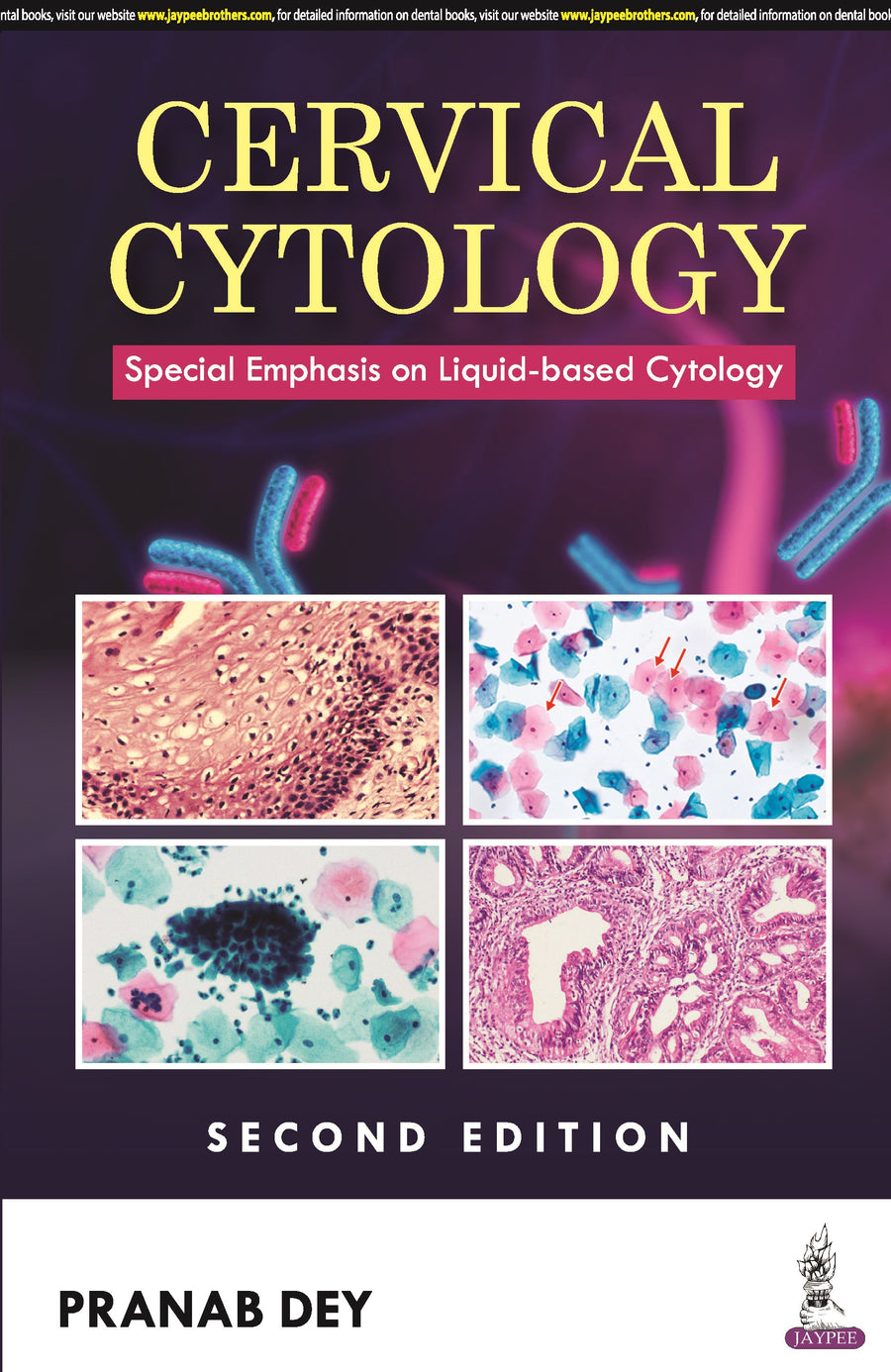 Cervical Cytology: Special Emphasis on Liquid-Based Cytology