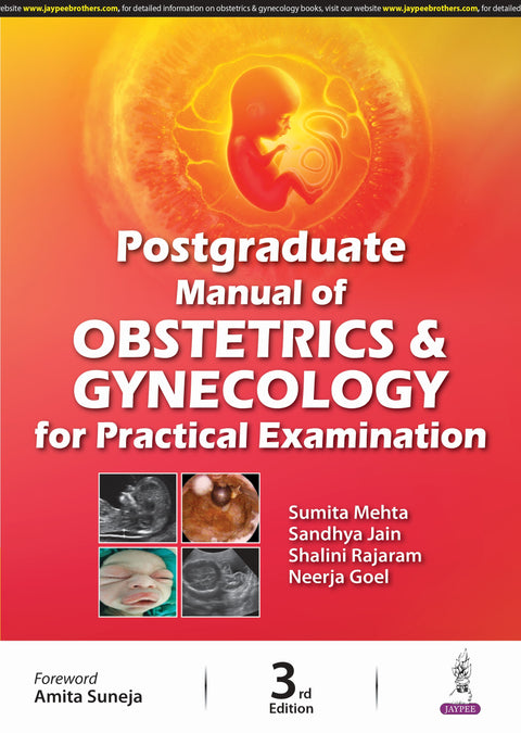 Postgraduate Manual of Obstetrics & Gynecology for Practical Examination