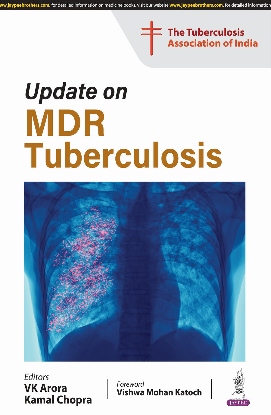 Update on Mdr Tuberculosis