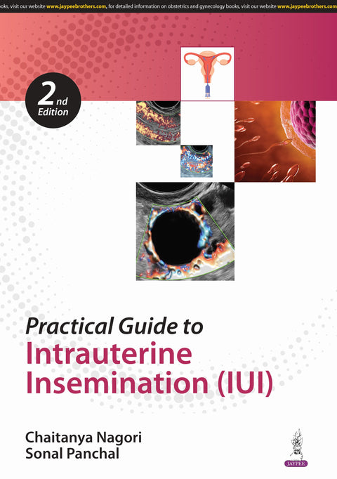 Practical Guide to Intrauterine Insemination (Iui)