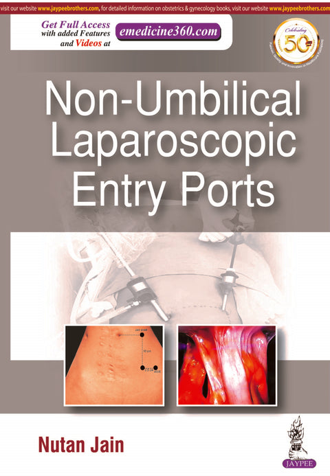 Non-Umbilical Laparoscopic Entry Ports