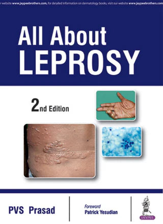 ALL ABOUT LEPROSY 2/E 2016
