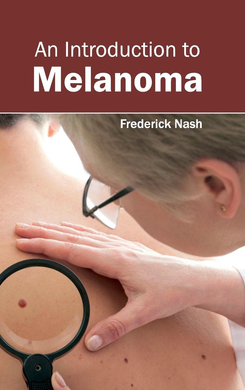An Introduction To Melanoma 1/E , 2015
