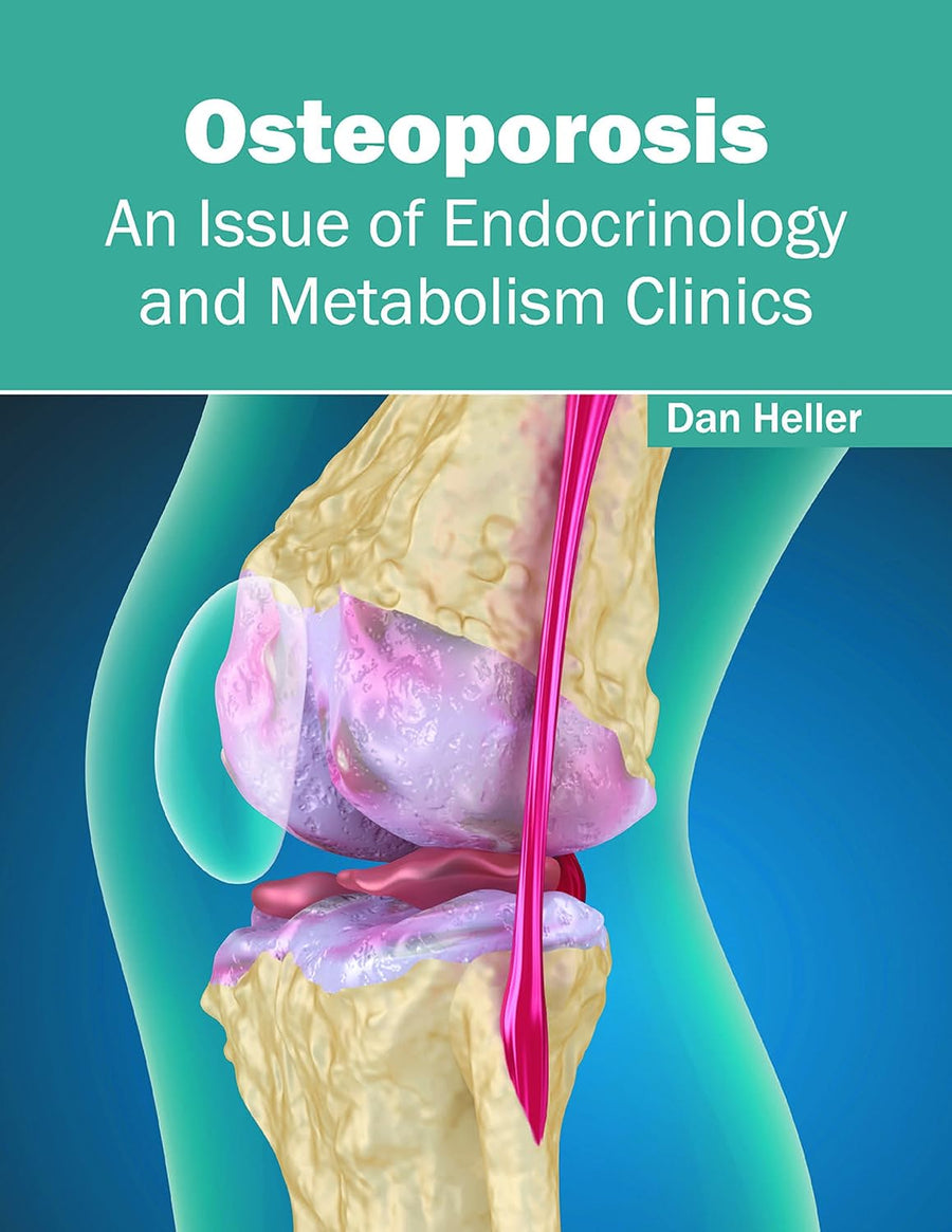 Osteoporosis: An Issue Of Endocrinology And Metabolism Clinics