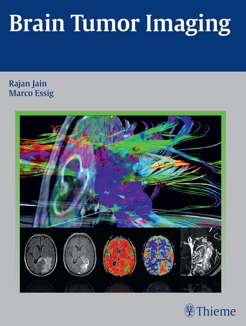 Brain Tumor Imaging