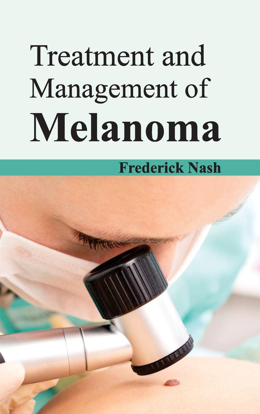 Treatment And Management Of Melanoma : 1/E 2015