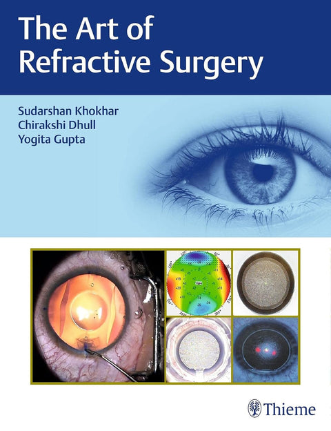 The Art of Refractive Surgery, 1E