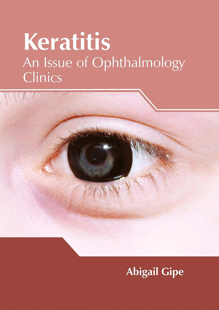 Keratitis: An Issue Of Ophthalmology Clinics; 1/E 2017