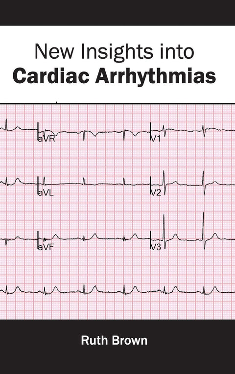 New Insights Into Cardiac Arrhythmias