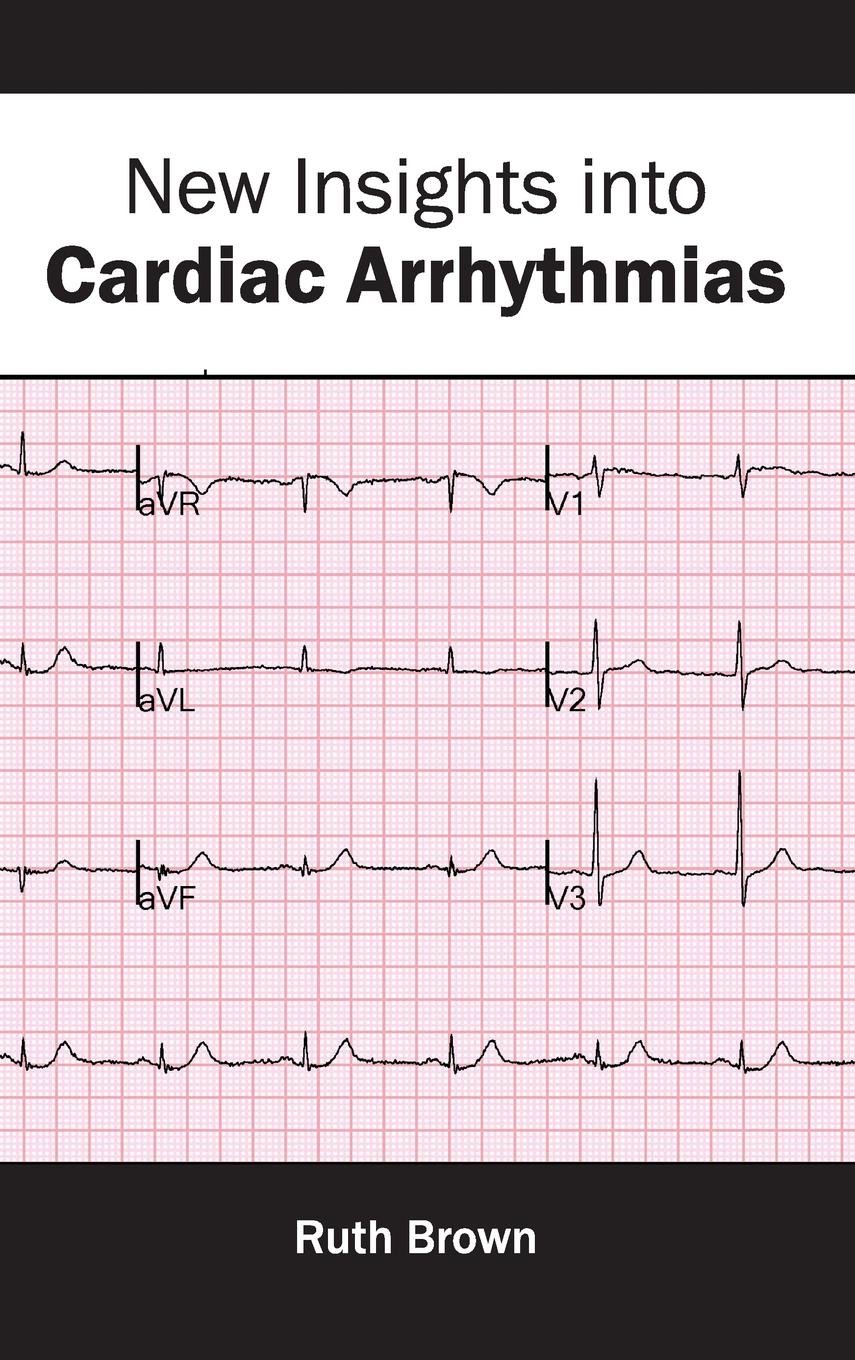 New Insights Into Cardiac Arrhythmias