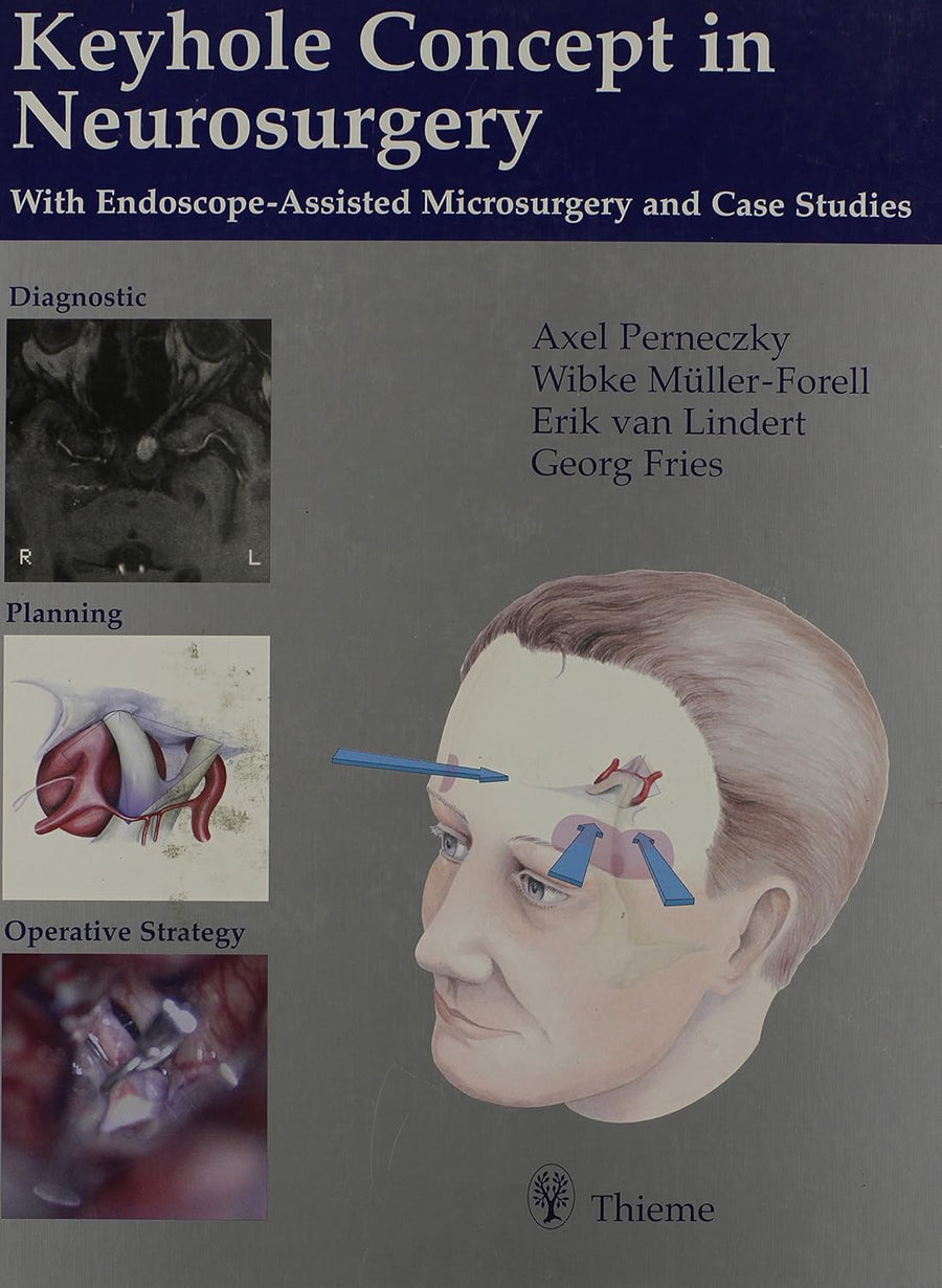 Keyhole Concept In Neurosurgery