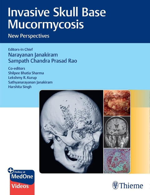 Invasive Skull Base Mucormycosis 1st Edition 2023